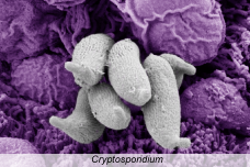 Cryptosporidium