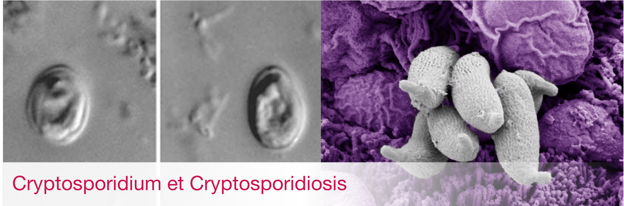 Cryptosporidium et Cryptosporidiosis