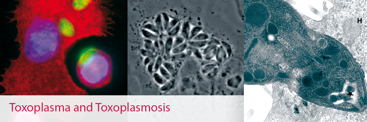 Toxoplasma and Toxoplasmosis